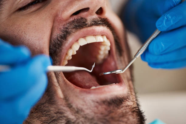 Best Urgent Tooth Repair  in Wenonah, NJ